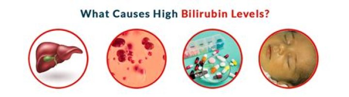Can fatty liver cause high direct bilirubin?