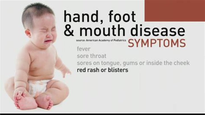 Can I get hand foot and mouth from my child?
