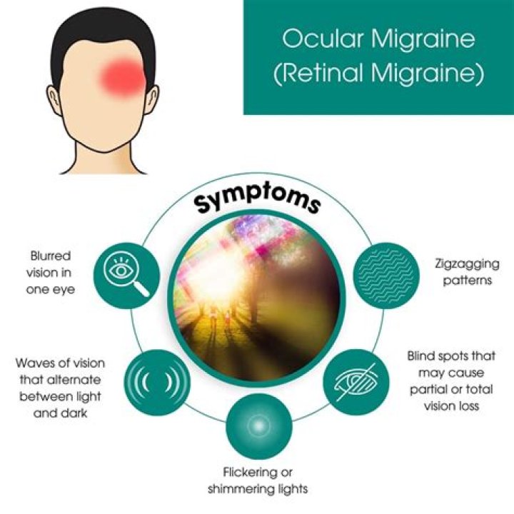 Can ocular migraine affect only one eye?