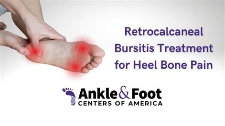 Can you get bursitis in your toe?