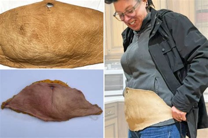 Can you preserve human skin?