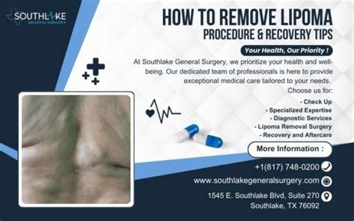 Can you squeeze out lipoma?