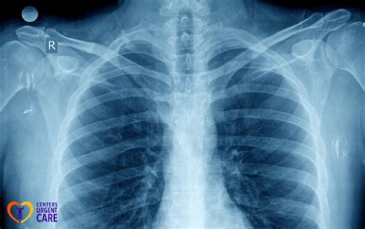 Do organs show up on X-rays?