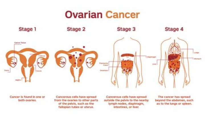 Does ovarian cancer show up in blood work?