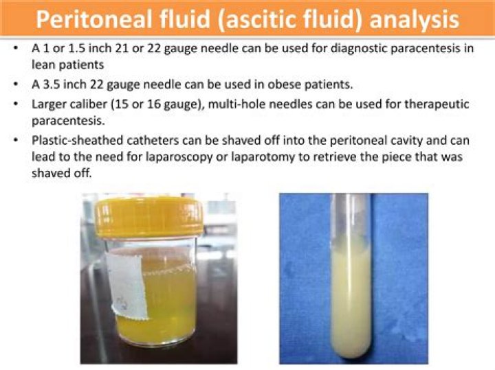 How do you calculate ascites fluid?