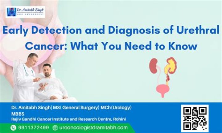 How do you know if you have urethral cancer?
