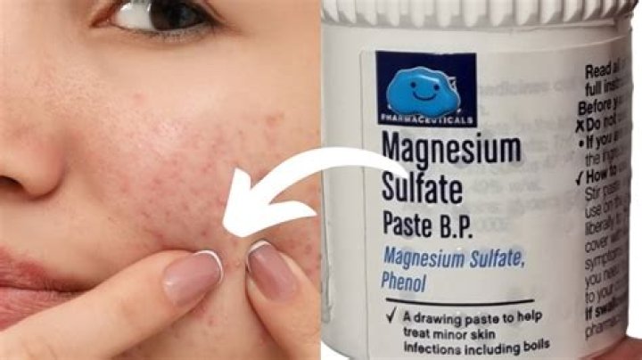How do you make magnesium sulphate dressing?