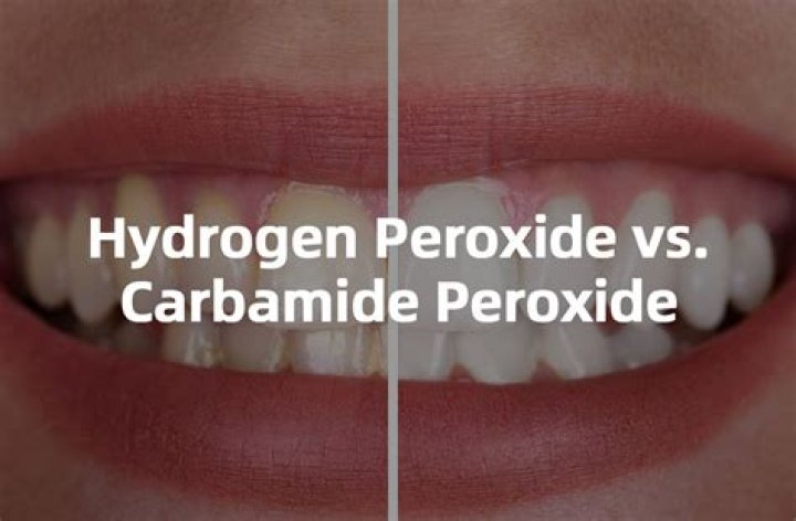 How long do you leave 22 carbamide peroxide on teeth?