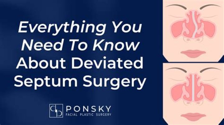 How long does it take to recover from a deviated septum surgery?