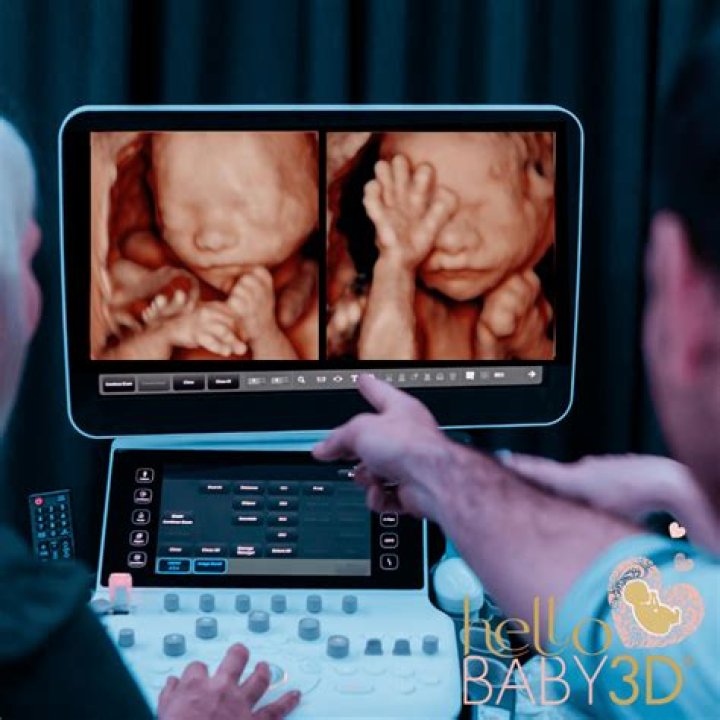 How many weeks is the best time to get a 3D ultrasound?