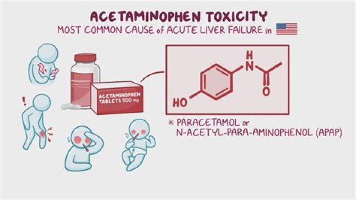 How will you manage a paracetamol overdose patient?