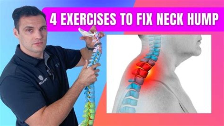 Is it normal to have a bump on the back of your neck spine?