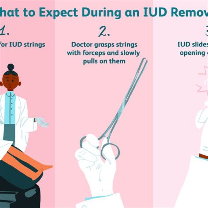 Is IUD removal or insertion more painful?