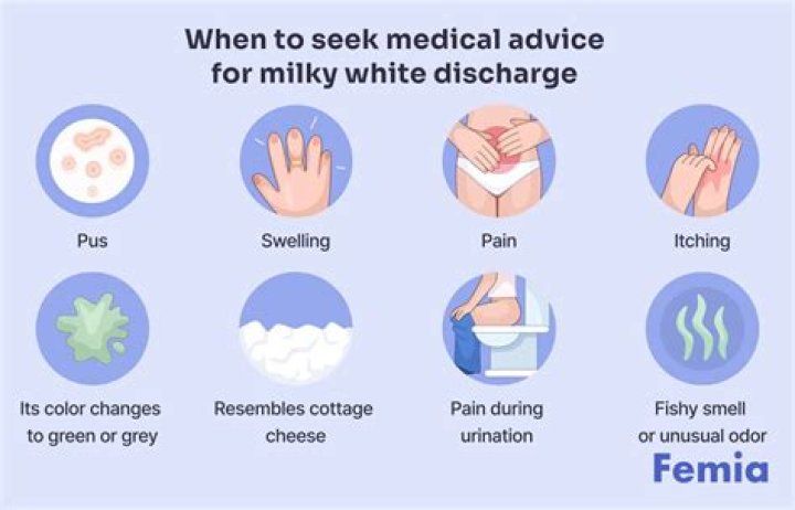 Is Milky odorless discharge normal?