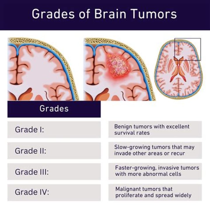 Is there a pill to shrink brain tumors?
