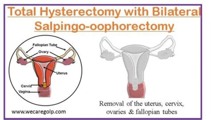 What are the side effects of salpingo oophorectomy?