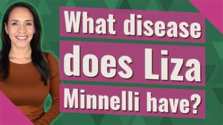 What disease does Liza Minnelli have?