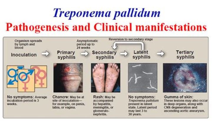 What disease is caused by Treponema pallidum?