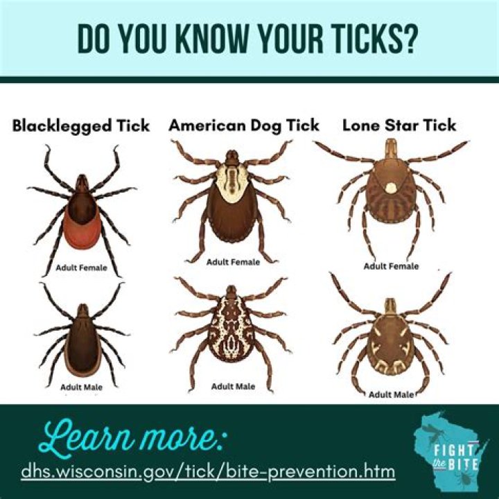 What do you do if a black leg tick bites you?