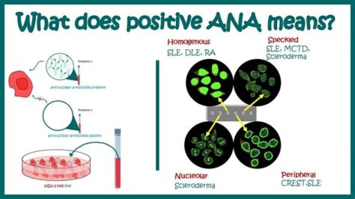 What does a positive ANA by HEp-2 mean?