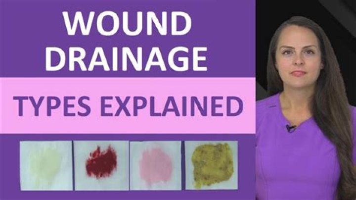 What does poor drainage mean?