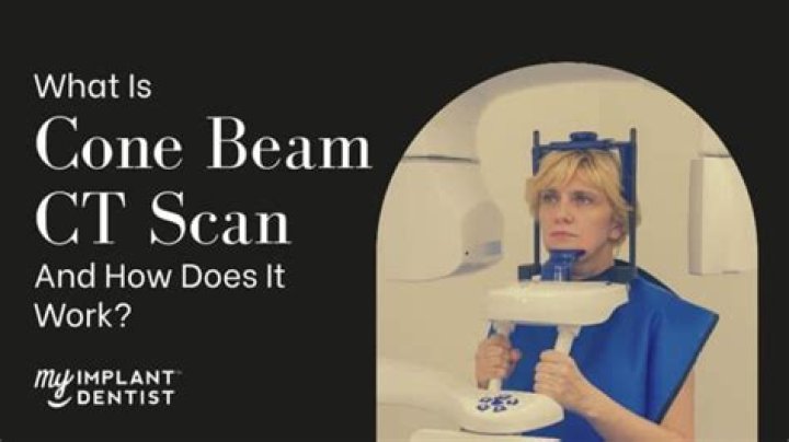 What is a cone beam xray?