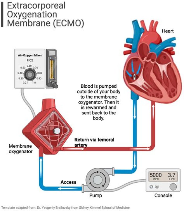 What is cardiac ECMO?