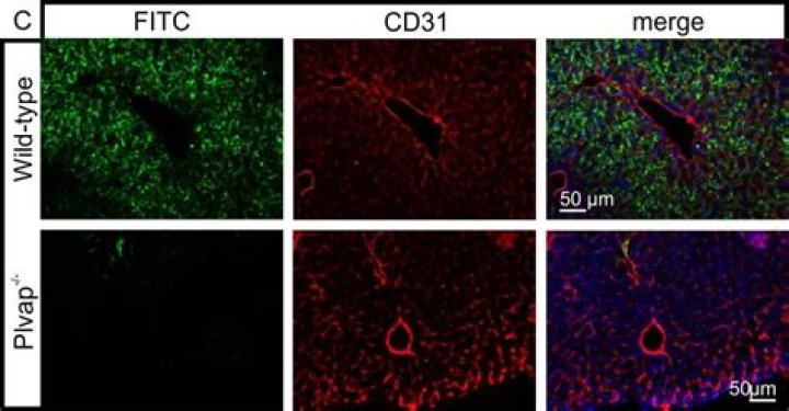 What is CD31 staining?