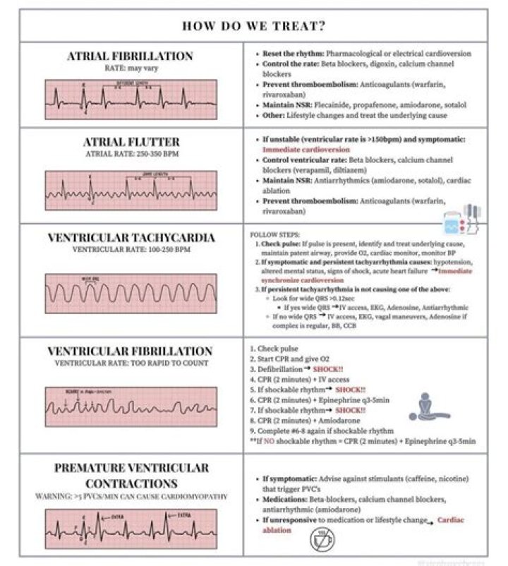 What is the best medication for arrhythmia?