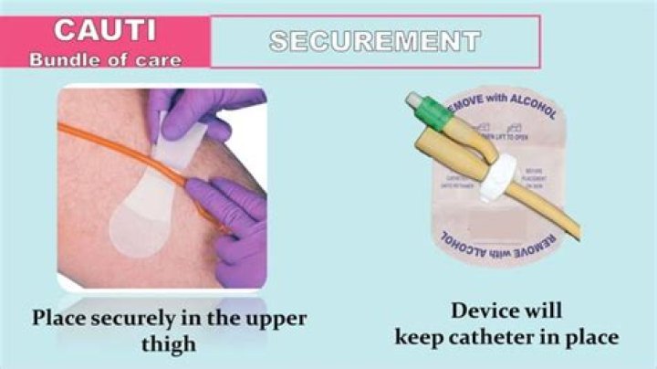What is the CAUTI bundle?