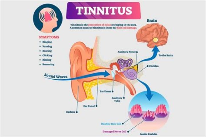 What is the fastest way to cure tinnitus?