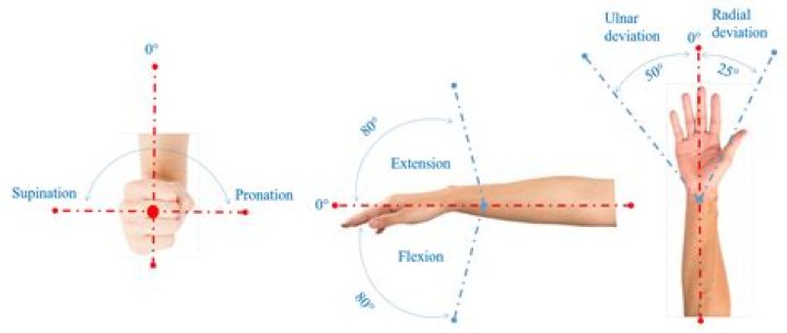 What is the normal range of motion after wrist surgery?