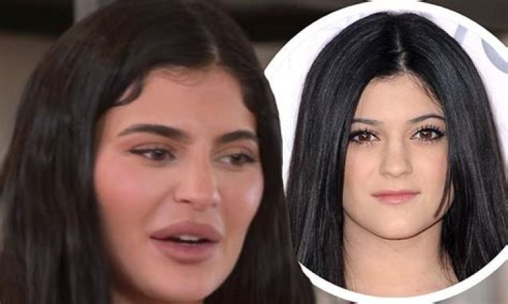 What Kim Kardashian done to her face?