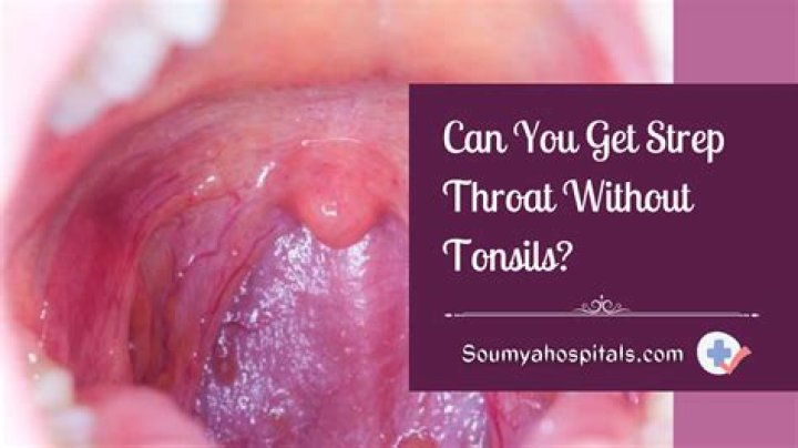What throat infections can you get without tonsils?