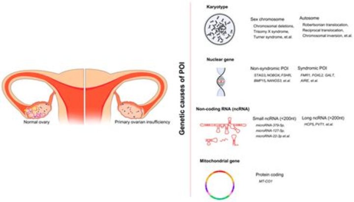 Which is the most common etiology of primary ovarian insufficiency in females 21 years of age?