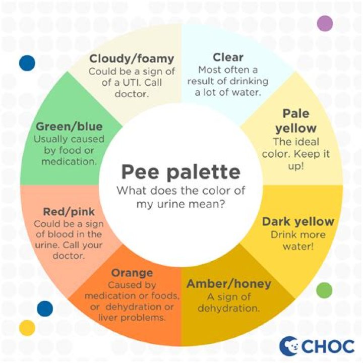 Why is my pee really yellow orange?